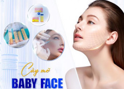 Cấy mỡ Baby Face – Phương pháp trẻ hóa hiện đại