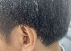 Máy trợ thính CIC - Máy trợ thính đeo trong tai