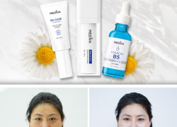 Khắc phục lão hóa da với bộ 3 siêu phẩm Mediva Retinol Rejuvenating Combo