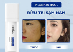 Điều gì tạo nên sự khác biệt của MEDIVA RETINOL 0.3%