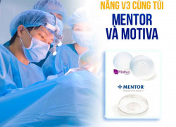 Túi Mentor và Motiva – Loại nào nâng cấp vòng 3 tốt nhất