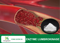 Enzyme Lumbrokinase – Hỗ Trợ Tuần Hoàn Máu & Phòng Ngừa Huyết Khối Tối Ưu