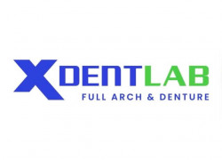 CTY  XDENT tuyển LĐPT làm ca sáng & ca tối tại Quận 6