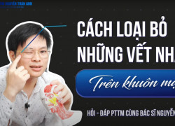Tiêm botox giảm nếp nhăn