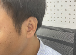 Máy trợ thính trong tai - máy trợ thính CIC
