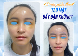 Tướng mặt tròn đầy đặn