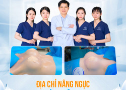 Chi phí thẩm mỹ v1 hiện nay là bao nhiêu ?
