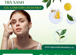 Chiết xuất trà xanh - Cứu cánh cho làn da mụn