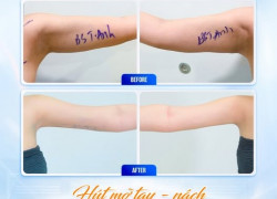 Bí Quyết Diện Đồ Đẹp Không Cần Che Giấu