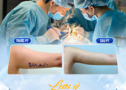 Bí quyết giảm mỡ để tự tin