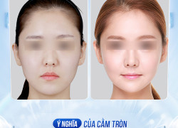 Cằm tròn đầy: Biểu tượng cuộc sống giàu sang viên mãn