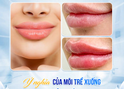 Môi trề xuống: báo hiệu vận hạn gì trong nhân sinh?