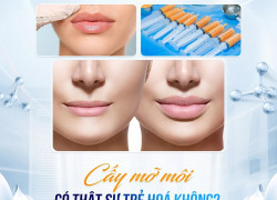 Cấy mỡ môi trên