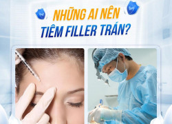 Tiêm filler trán và ảnh hưởng đến nhân tướng học