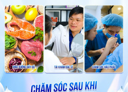 Mở góc mắt trong: Ai phù hợp, khi nào nên thực hiện