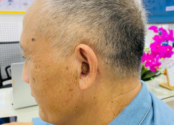 Máy trợ thính làm theo khuôn tai sẽ trông như thế nào?