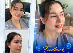 Giải pháp cho diện mạo thanh thoát và tự tin hơn