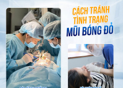 Mũi bị bóng đỏ – Dấu hiệu bạn không nên bỏ qua