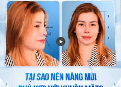 Tạo dáng mũi tự nhiên cùng phương pháp làm đẹp hiện đại