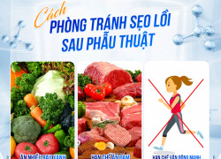 Có nên nâng mũi và cắt mí cùng lúc không