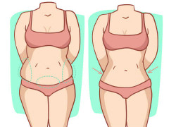 Hút mỡ bị lồi lõm có chỉnh sửa được không?