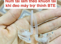 Vì sao cần làm khuôn tai dành cho máy sau tai