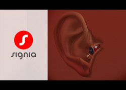 INSIO 1NX – Máy trợ thính CIC nhỏ gọn, hiệu quả vượt trội