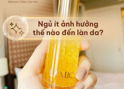 Ngủ ít ảnh hưởng thế nào đến làn da?