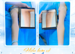 Sau giảm mỡ bụng ăn gì để đảm bảo kết quả như mong muốn?