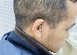 Nghe kém ở người trẻ tuổi, đừng chủ quan!