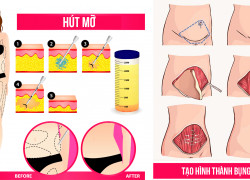 Tạo hình bụng: lợi ích và những rủi ro cần biết