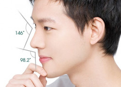 Nâng mũi cho nam giới cần lưu ý điều gì để giữ vẻ nam tính