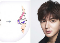 Những điều nam giới cần biết trước khi nâng mũi