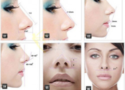 Dáng mũi phổ biến trong phẫu thuật thẩm mỹ hiện nay