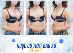 Xử lý co thắt bao xơ sau nâng ng.ực Những điều cần biết