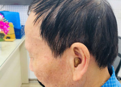 Máy trợ thính siêu nhỏ trong tai CIC