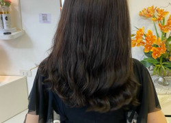 Tóc thưa hói đỉnh đầu siêu da có phải giải pháp tốt nhất?