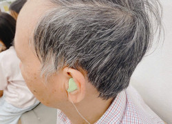 Ù tai nhưng vẫn nghe được, có cần đi khám không