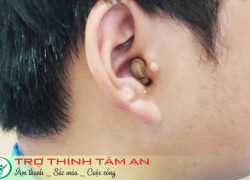 MÁY TRỢ THÍNH ĐEO TRONG TAI CIC, THẨM MỸ