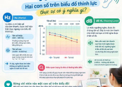 Hz và dB TRÊN BIỂU ĐỒ THÍNH LỰC CÓ Ý NGHĨA GÌ?